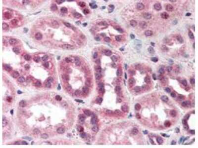 Immunohistochemistry: Cullin 5 Antibody [NBP1-78041] - Cullin 5 antibody was diluted 1:500 to detect Cullin 5 in human kidney tissue. Tissue was formalin fixed and paraffin embedded. No pre-treatment of sample was required. The image shows the localization of antibody as the precipitated red signal, with a hematoxylin purple nuclear counter stain.